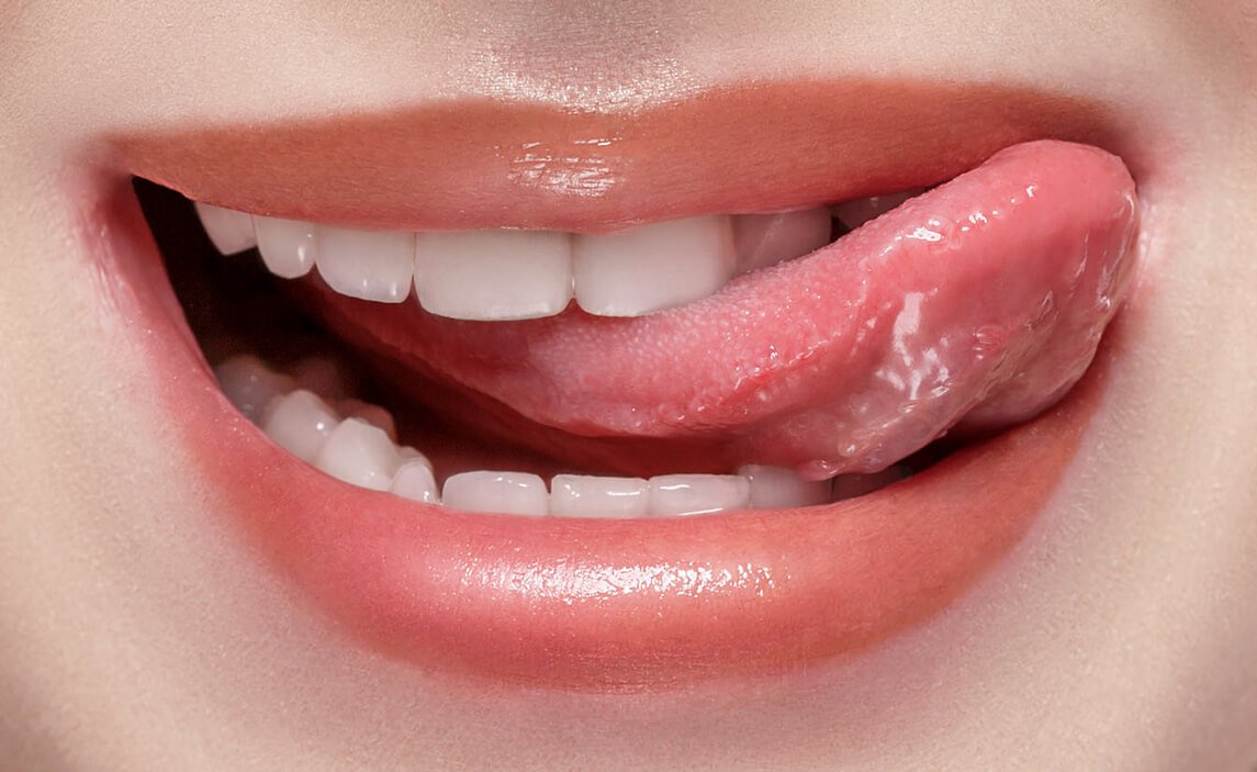 Cirugía Dental - Frenillo lingual | Santa Perpetua Clínica Dental